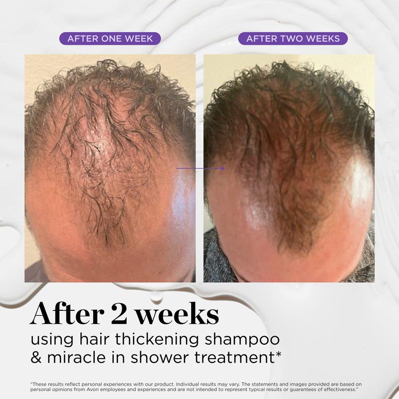 Advanced Hair Growth Roll-On Serum