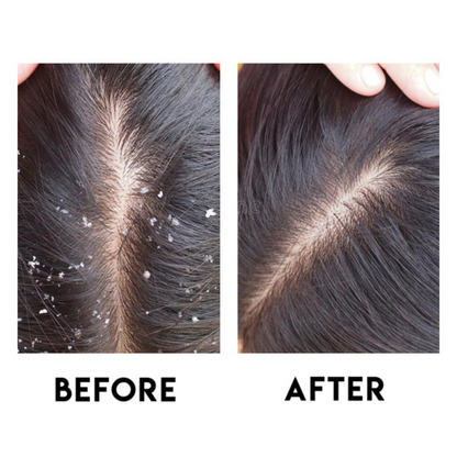 Dr. Roots Dynamic Hair & Scalp Duo