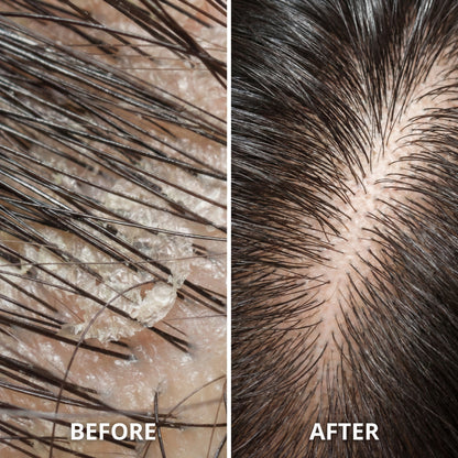 Dr. Roots Anti-Dandruff & Hair Strengthening Duo